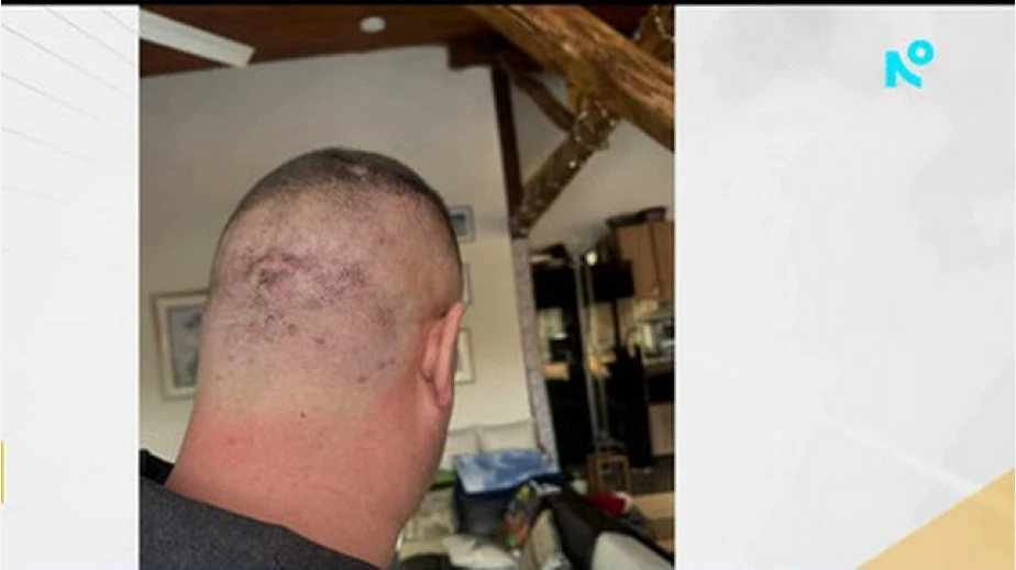 Завързан с белезници и ритан в главата: Мъж твърди, че е жестоко пребит в  дискотека